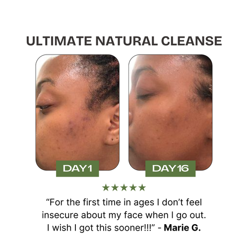 Premium Olive Oil Soap